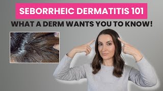 Seborrheic Dermatitis Gets Worse When You Do This