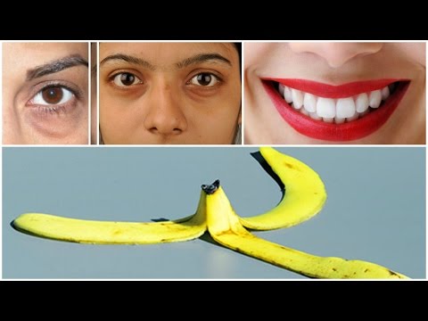 Best Beauty Benefits of Banana peel/home remedies for puffy eye,dark circles,teeth whitening