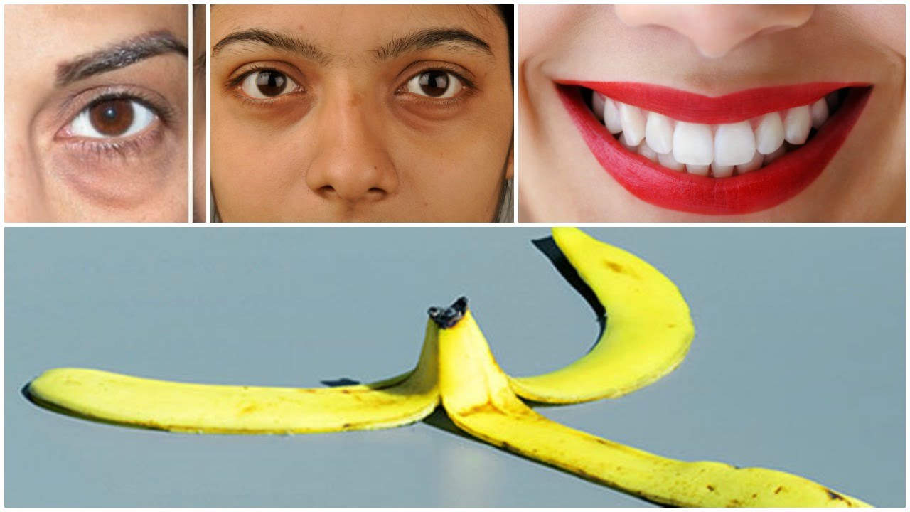 <h1 class=title>Best Beauty Benefits of Banana peel/home remedies for puffy eye,dark circles,teeth whitening</h1>