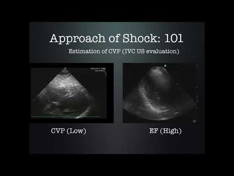Approach to Shock Using Ultrasound by Dr. Zevallos