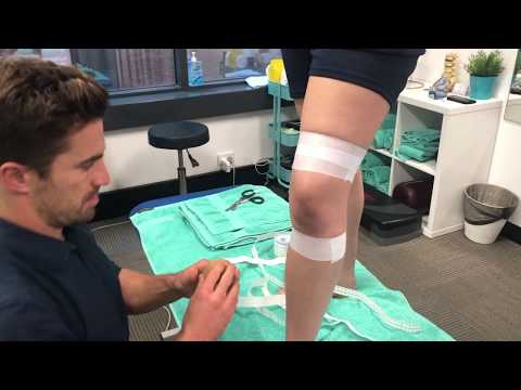 ACL Taping Technique with Physiotherapist  Ryan Dorahy