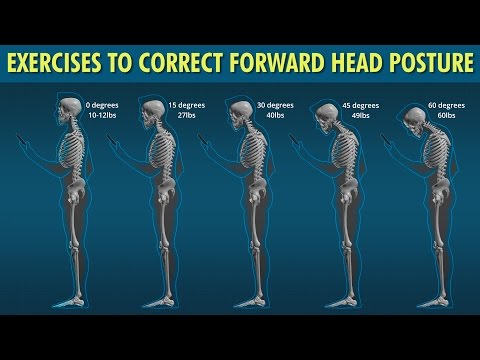 Forward Head Exercises to Correct Posture