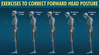 Forward Head Exercises to Correct Posture