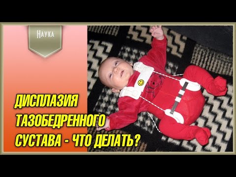 Правосторонний сколиоз грудного отдела позвонка Лечение грыжи позвоночника настойкой окопника