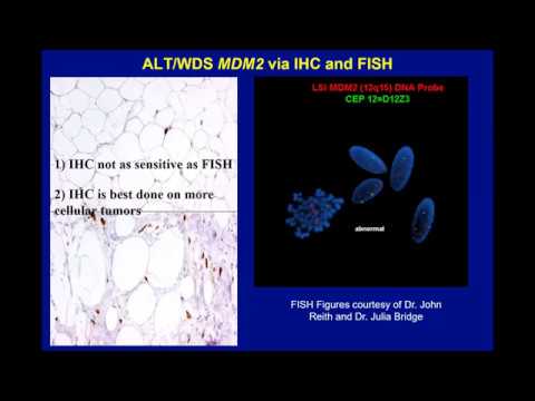 Atypical Lipomatous Tumor and Dedifferentiated Liposarcoma. When are molecular tests appropriate?
