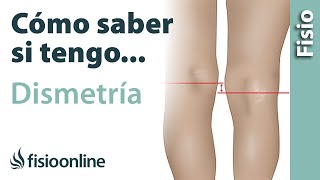 Cómo saber si tienes una PIERNA más CORTA o Dismetría