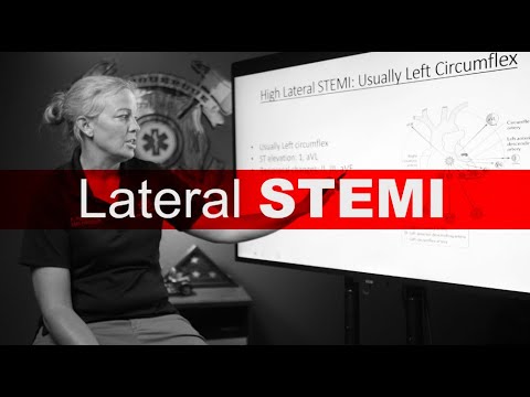 Lateral Stemi