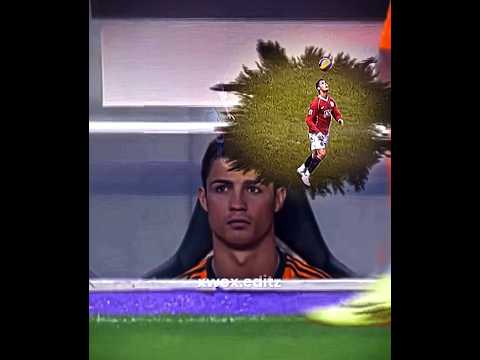 Ronaldos Injury 😔🐐 #capcut #template #shortsvideo