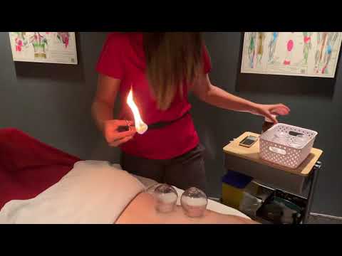 Fire cupping set
