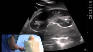 Product video: CAE Blue Phantom Central Line Ultrasound Training Models