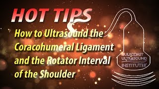 How to Ultrasound the Coracohumeral Ligament and Rotator Interval of the Shoulder