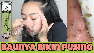 NYOBAIN GEL HUT MUN (pencabut komedo) | Indira Kalistha