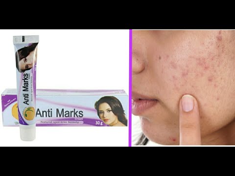Overview of Anti Marks Cream