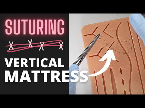 Mastering The Vertical Mattress Suture