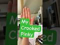Crooked Pinky #shorts - Weird Health Crooked Pinky #shorts