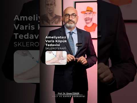 Ameliyatsız Varis Köpük Tedavisi (SKLEROTERAPİ) Nedir?