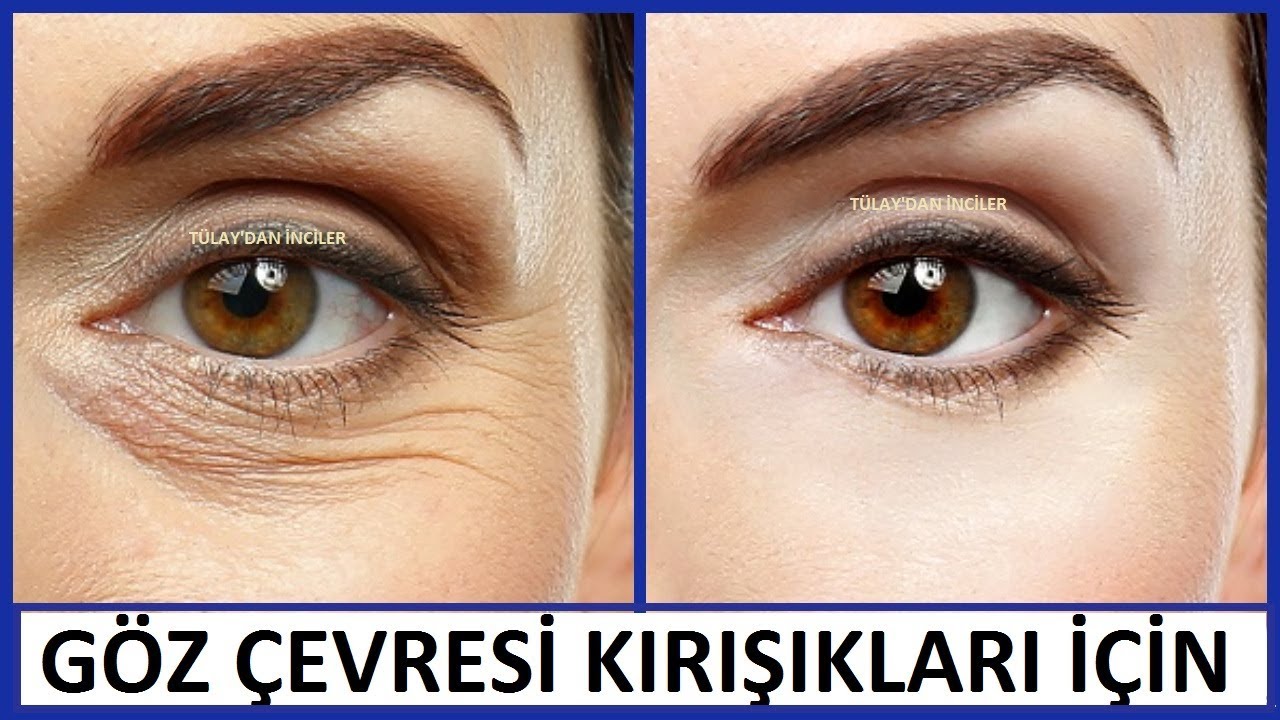 Güneş Lekelerini Gideren Çok Özel 4 Maske Tarifi Güneş Lekelerini Gideren Çok Özel 4 Maske Tarifi