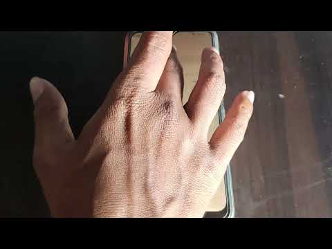 how to set switch access settings Moto e13, Moto e13 accessibility setting