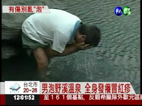 男泡野溪溫泉 皮膚感染綠膿桿菌