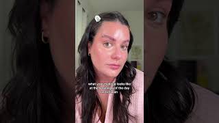 I’ll take the dry skin from tretinoin over my acne tho 🤞🏼🥲 #tretinoin #shorts