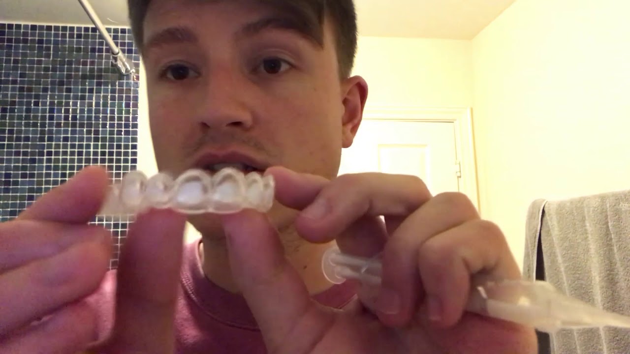 How did I get my teeth so white!