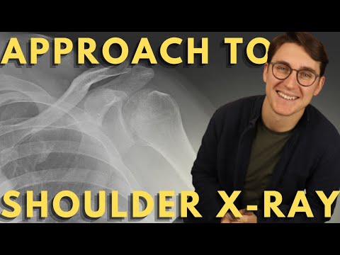 Shoulder X-ray interpretation | How to read a trauma shoulder X-ray