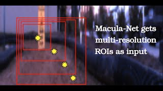 The Macula-Net: Perceptual Attention-based Predictive Control