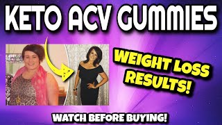 KETO ACV GUMMIES Review (WATCH BEFORE BUYING!!) | Keto ACV Gummies For Weight Loss REAL Results!!