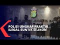Malpraktik Filler Payudara Pelaku Pakai Silikon Industri Tanpa Merek Dan Izin Edar