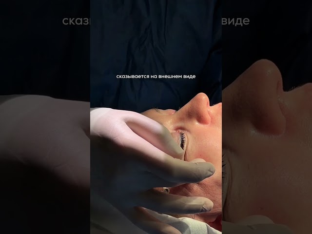 О ЧЕМ ЗАБЫВАЮТ В ЗОНЕ ЛИЦА?