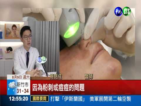 夏天油脂分泌旺 診所推代客洗臉