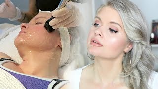 Non Surgical Facelift For Neck | Forma Skin Tightening Review | Skin Spa New York Back Bay