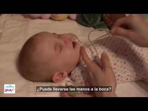 SMArt Moves en español - Antigravedad en Atrofia Muscular Espinal (Video 2)