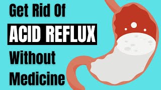 How To Get Rid Of Heartburn (Acid Reflux) Without Medicine