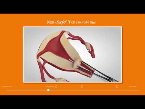 Neo-Safe T CU 380/380 Mini Einführanleitung