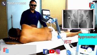 AVN( AVASCULAR NECROSIS) HIP | ऑपरेशन से बचें | लेजर(LASER) से होगा रिपेयर | DR.HARAPRASAD