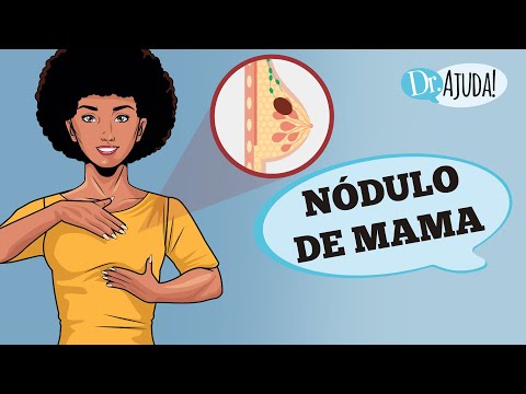 NÓDULO DE MAMA: É BENIGNO OU CÂNCER DE MAMA? COMO É O DIAGNÓSTICO E TRATAMENTO?
