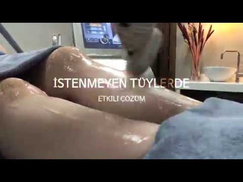 Pervin Dinçer | Buz Lazer Epilasyon Uygulaması