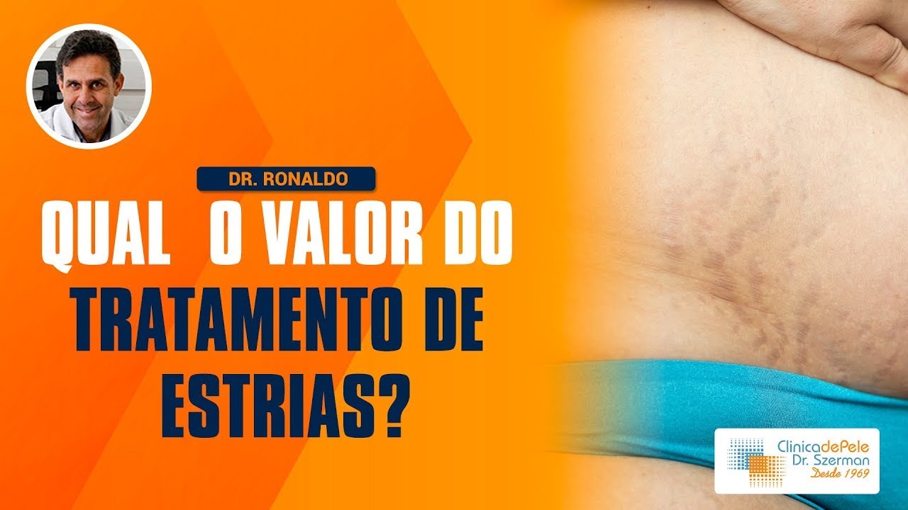 Quanto custa o tratamento das estrias?