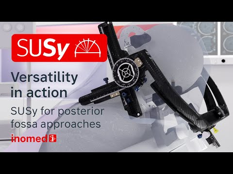 Versatility in action - SUSy for posterior fossa approaches - inomed