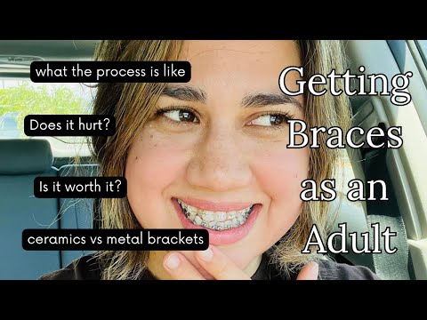 Getting Braces as an Adult | What to Expect