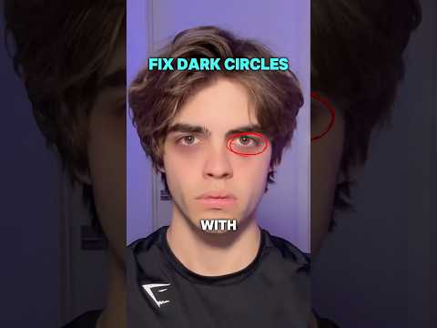 How to fix eye bags and dark circles 😱
