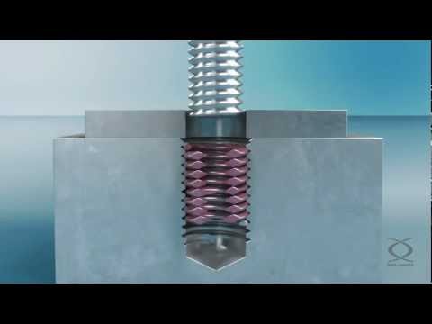 HELICOIL® Plus Screwlock – Coil thread inserts for metals with screw-locking effect