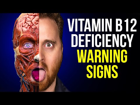 10 Vitamin B12 Deficiency Symptoms To Never Ignore