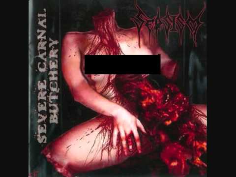Sepsism - Vulgar Strangulation  - Severe Carnal Butchery 1995
