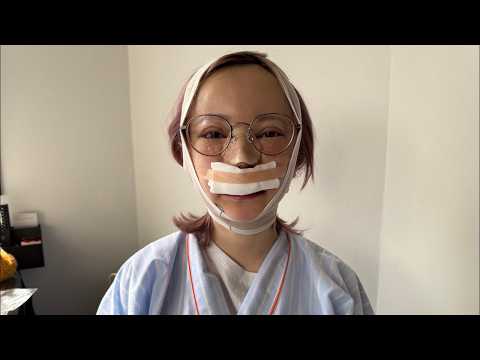 まりなの顔面が大変な事になりました。