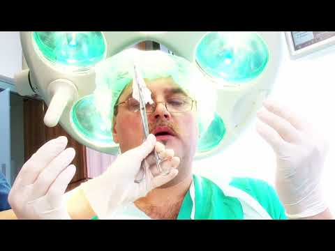 Dzino Show - Mono operacija