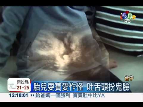 給爸媽一個勝利 寶貝肚中比YA