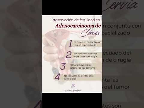 Zaniru Raúl Marín Martínez-11