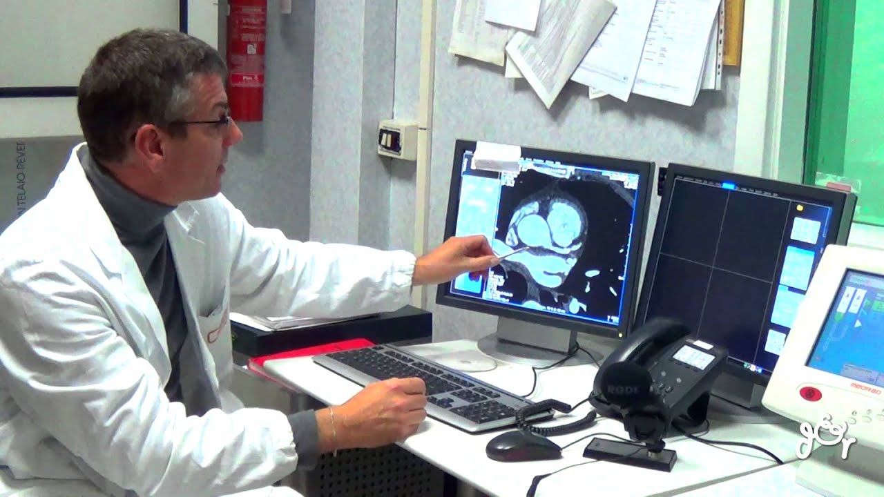 Watch Now TAC e Risonanza Magnetica all'avanguardia per Indagini non Invasive TAC e Risonanza Magnetica all'avanguardia per Indagini non Invasive